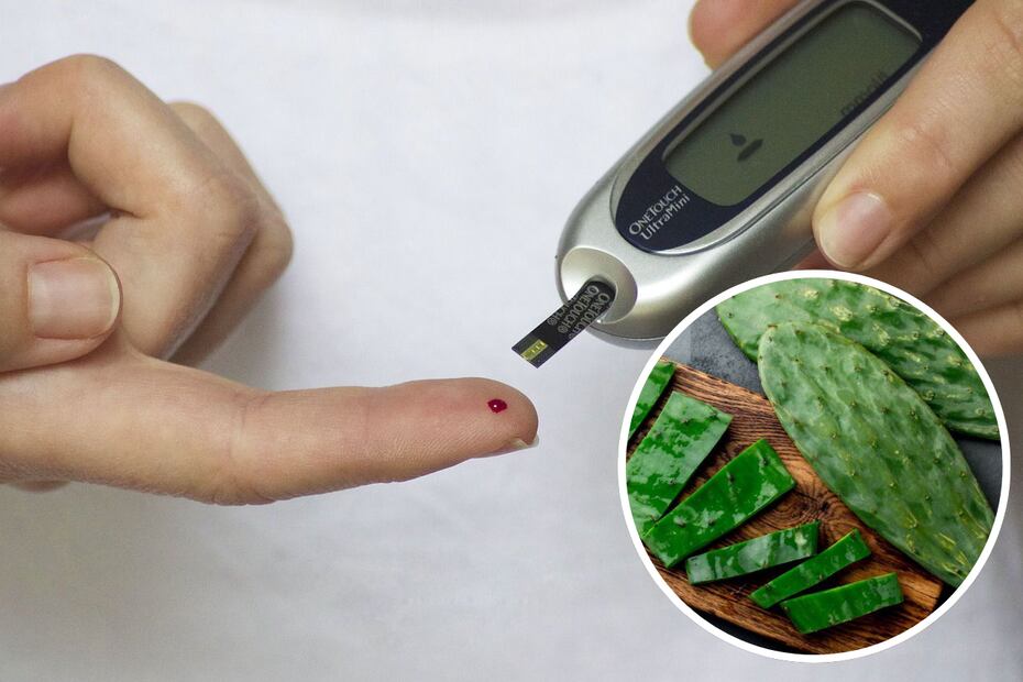 El nopal ayuda a controlar la diabetes. Foto: Archivo / EL UNIVERSAL