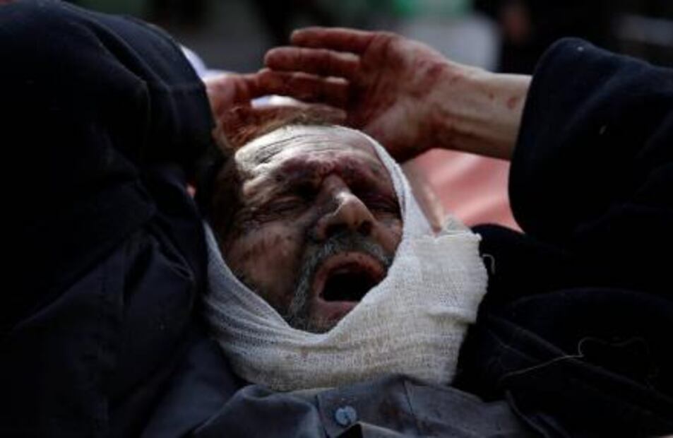 Atentado con coche bomba en Kabul deja 95 muertos