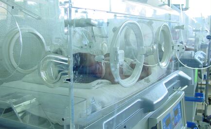 Avanza diagnóstico de enfermedades raras en recién nacidos: SSA