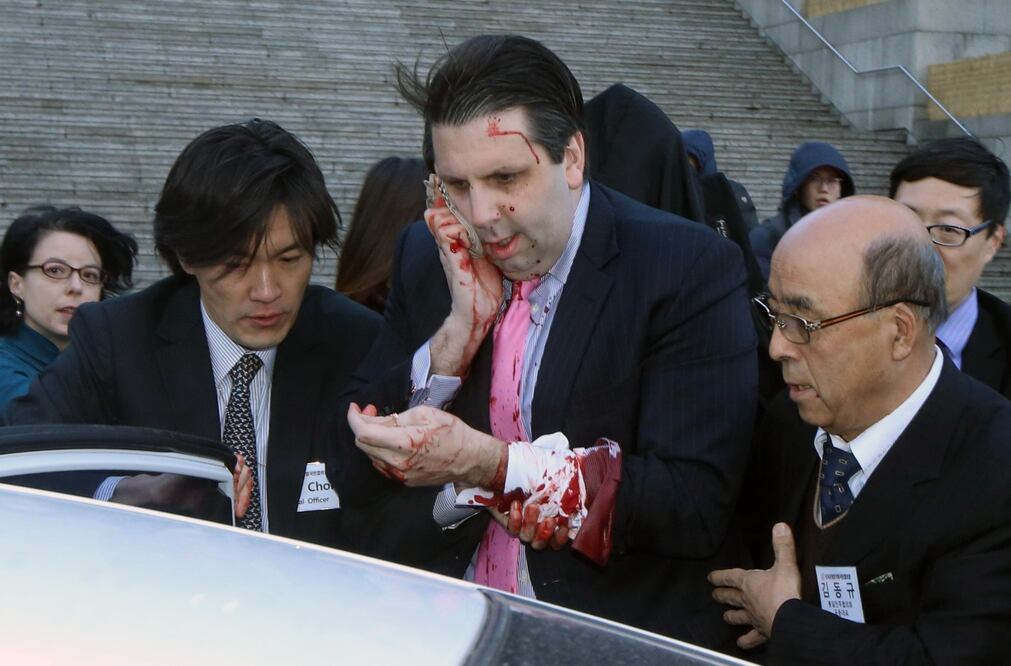 El hombre infligió varias heridas en el rostro y en manos al diplomático, que iba a participar en un foro (ARCHIVO AP)