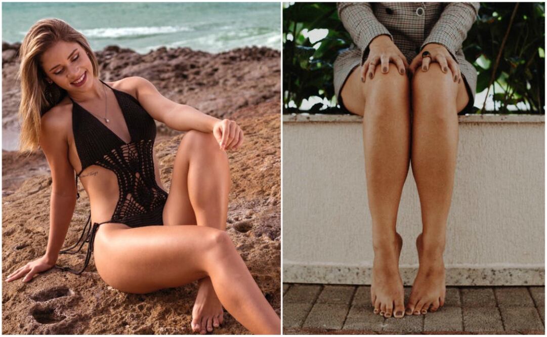 Despídete de los molestos vellos encarnados (Foto: Cortesía) 