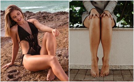 Beauty tips: ¡No más vellos encarnados!