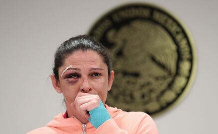 "Es un hecho cobarde", asegura Ana Guevara tras agresión