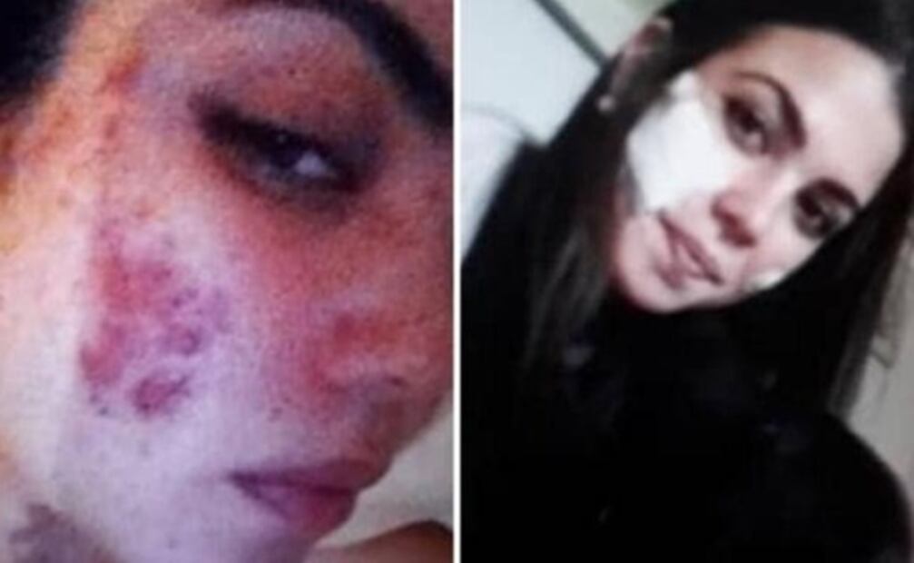 Concursante de Miss Universo muestra cómo superó daños en su cara por una cirugía estética