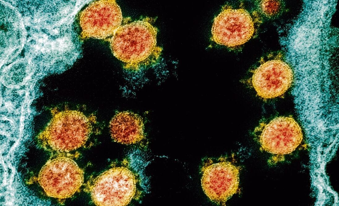 Foto: NIAID/National Institutes of Health via AP
