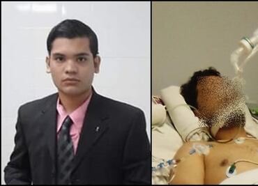 Desahucian a becario que quedó prensado entre láminas metálicas en Oaxaca