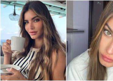 Génesis Aleska, exnovia de Nicky Jam, muestra impactantes fotos de su alopecia por ansiedad