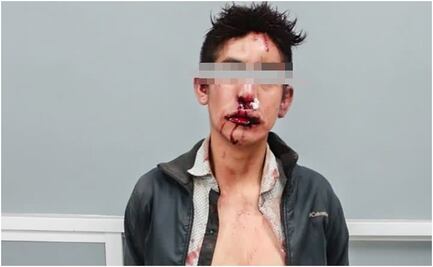 ¡Se busca! Vecinos intentan linchar a sujeto que mató a niña de 2 años; policías lo trasladan al hospital y escapa