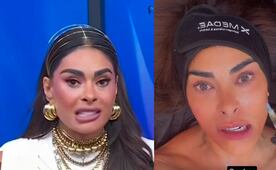 ¿Galilea Montijo es adicta a las cirugías? Sorprende con nuevo arreglito en el rostro 