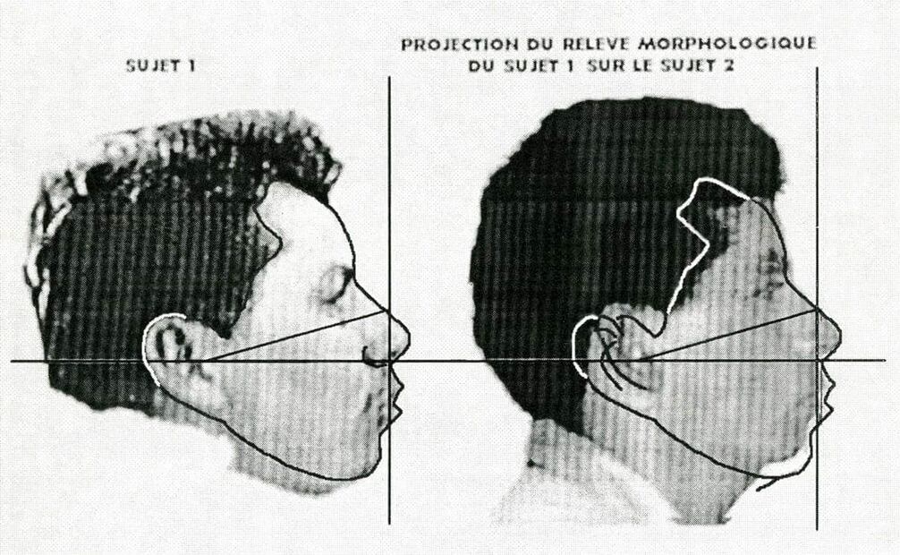 Según un estudio somatométrico, las medias faciales variaron entre el detenido en Lomas Taurinas y el presentado en Almoloya; el primero tiene 4.5 centímetros de frente y el segundo tiene 7.7. Foto: Archivo EL UNIVERSAL.