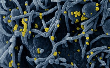 18 científicos creen posible que el coronavirus salió de un laboratorio