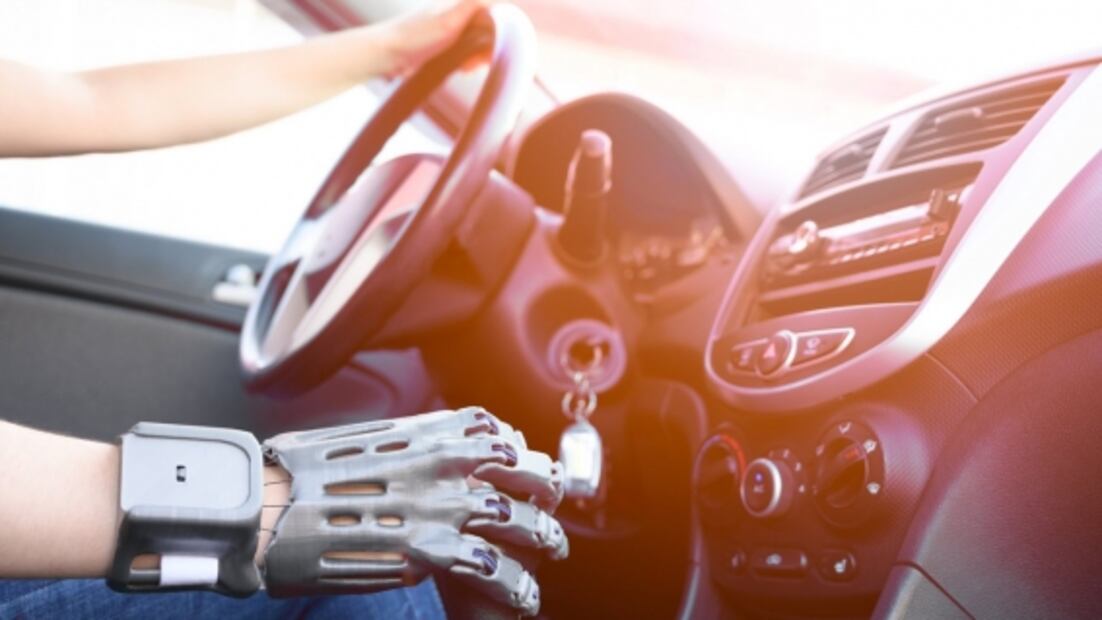 La tecnología está cada vez más cerca de la creación de cíborgs