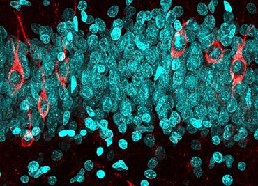 Con muestras de cerebros, expertos descubren que las neuronas se generan a lo largo de toda la vida