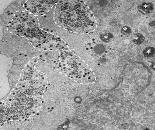 Descubren en Brasil el Yaravirus, un misterioso virus inocuo para humanos