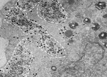 Descubren en Brasil el Yaravirus, un misterioso virus inocuo para humanos