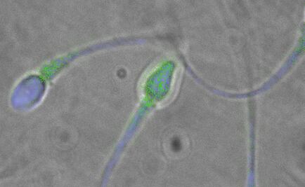 En el semen humano viven al menos 27 virus