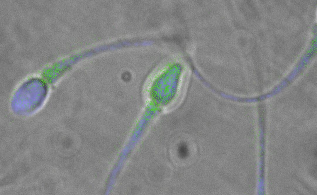 El semen es un marcador de salud, y este puede albergar cerca de 27 virus. (THEODORE L. TOLLNER PARA LN/ ARCHIVO)