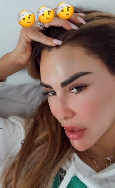 Ninel Conde sufre desmayo que le provoca un moretón en la frente.