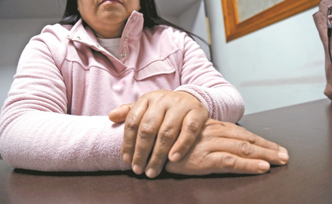 Luciana se describe como una superheroína. Relata que pudo sobrevivir violencia familiar, sexual (su hermano la violó), física y sicológica (su expareja la insultaba y golpeó su cara con una roca hasta dejarla inconsciente). Foto: JORGE ALVARADO