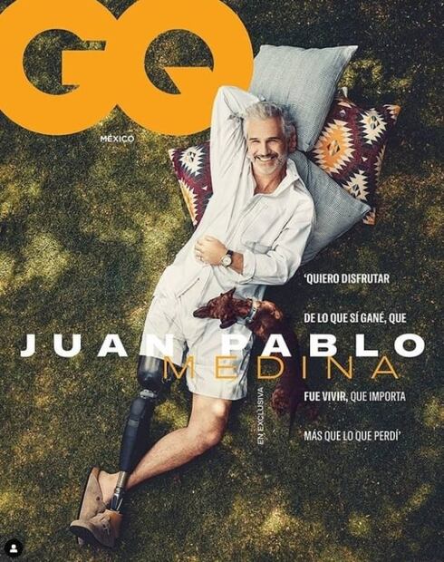 La vida después de una amputación: Juan Pablo Medina y el caso de otros famosos 