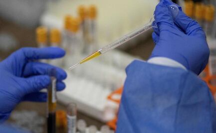 Vacunas no significan fin de la pandemia del Covid-19, advierte la OPS