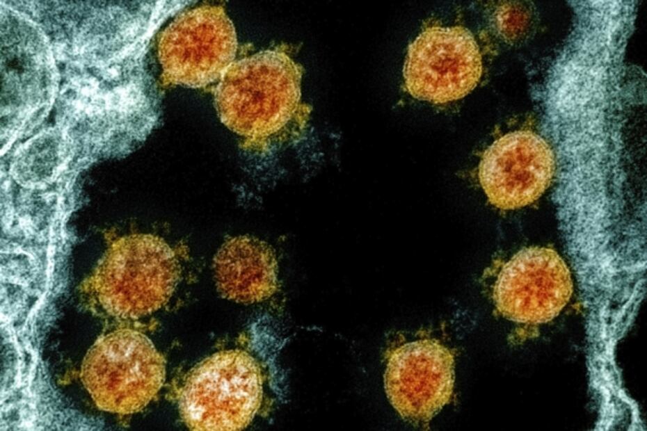 Covid-19: El coronavirus sobrevive en la piel hasta nueve horas