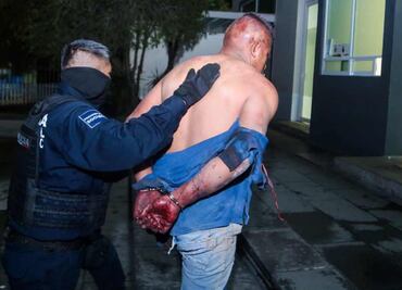 Policías municipales arrestan a sujeto que agredió a balazos a cuatro vecinos en Ecatepec