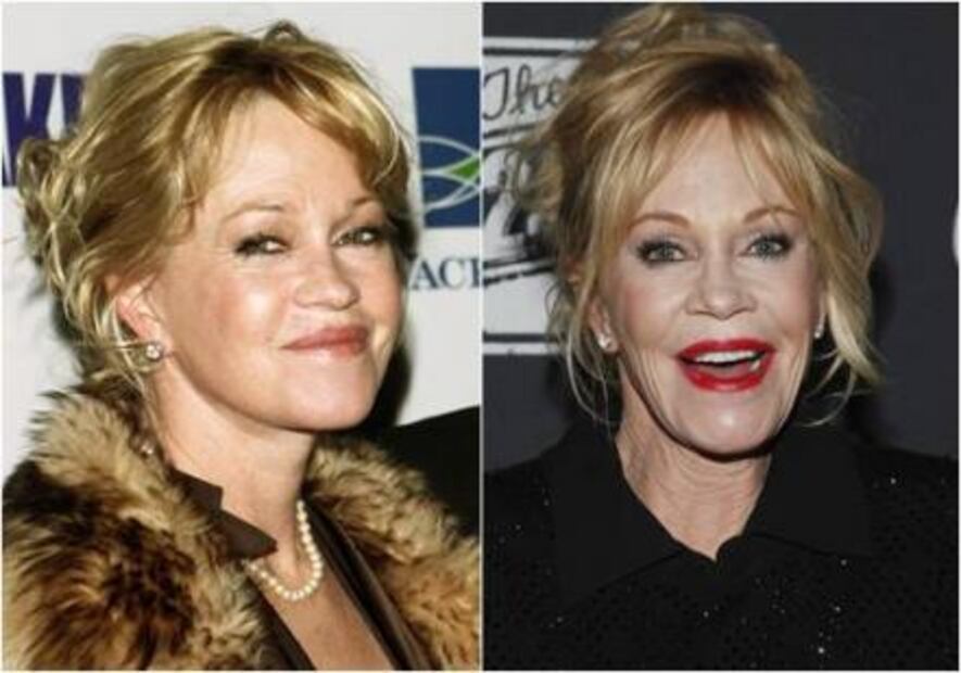 Así se ha transformado el rostro de Melanie Griffith