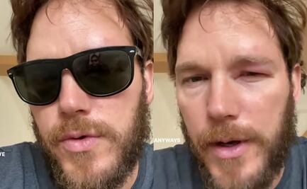 Eso de andar de valiente no le funcionó, abeja pica el ojo de Chris Pratt