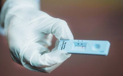 Esta nueva prueba rápida detecta la covid-19 en 10 minutos