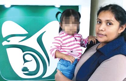 Extraen tumor en cara de una niña en el IMSS