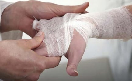 Descarta Ssa que lepra sea problema de salud pública