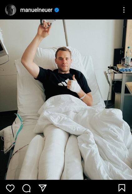 Manuel Neuer sufre accidente en sus vacaciones y es baja el resto de la temporada con el Bayern Munich 