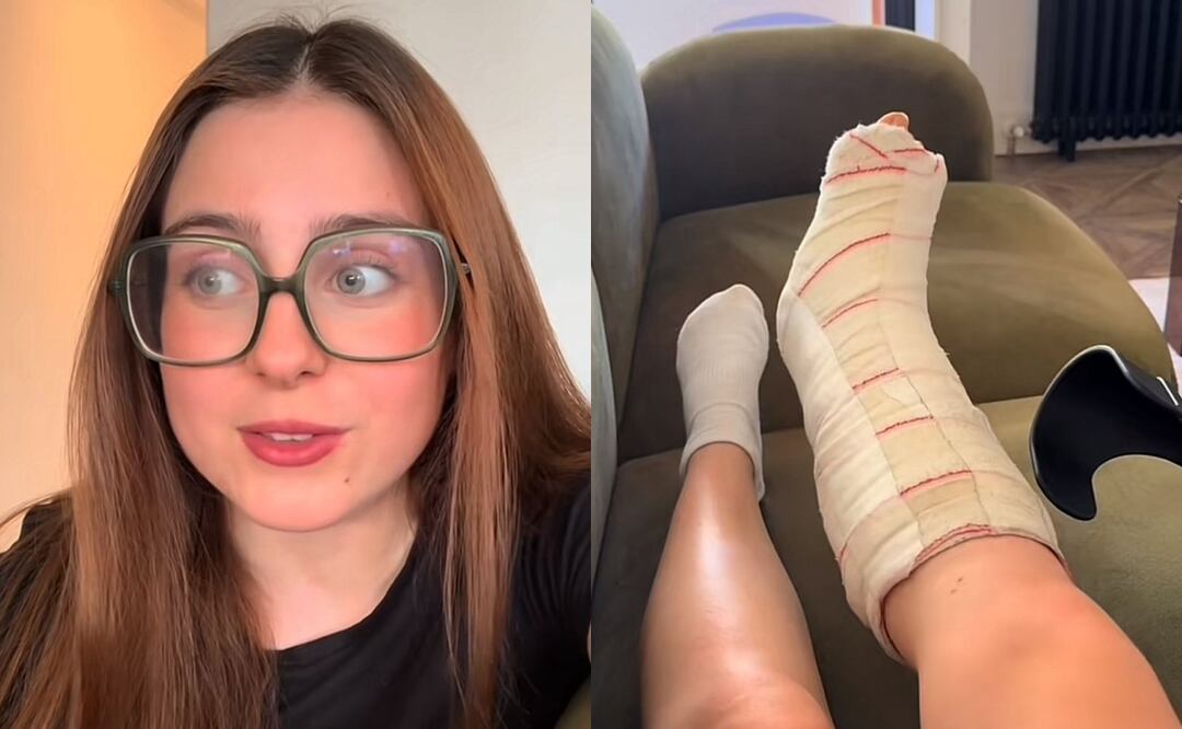 La tiktoker preocupó a sus seguidores al confirmar que sufrió una lesión. Foto: Redes Sociales