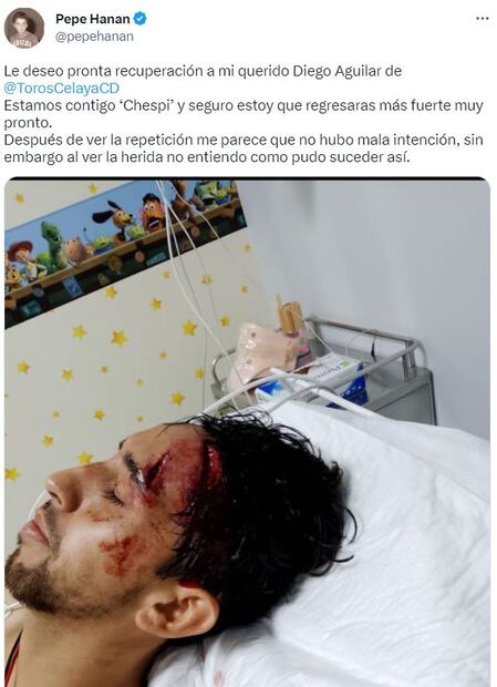 Así quedó la herida del Diego Aguilar, jugador del Celaya