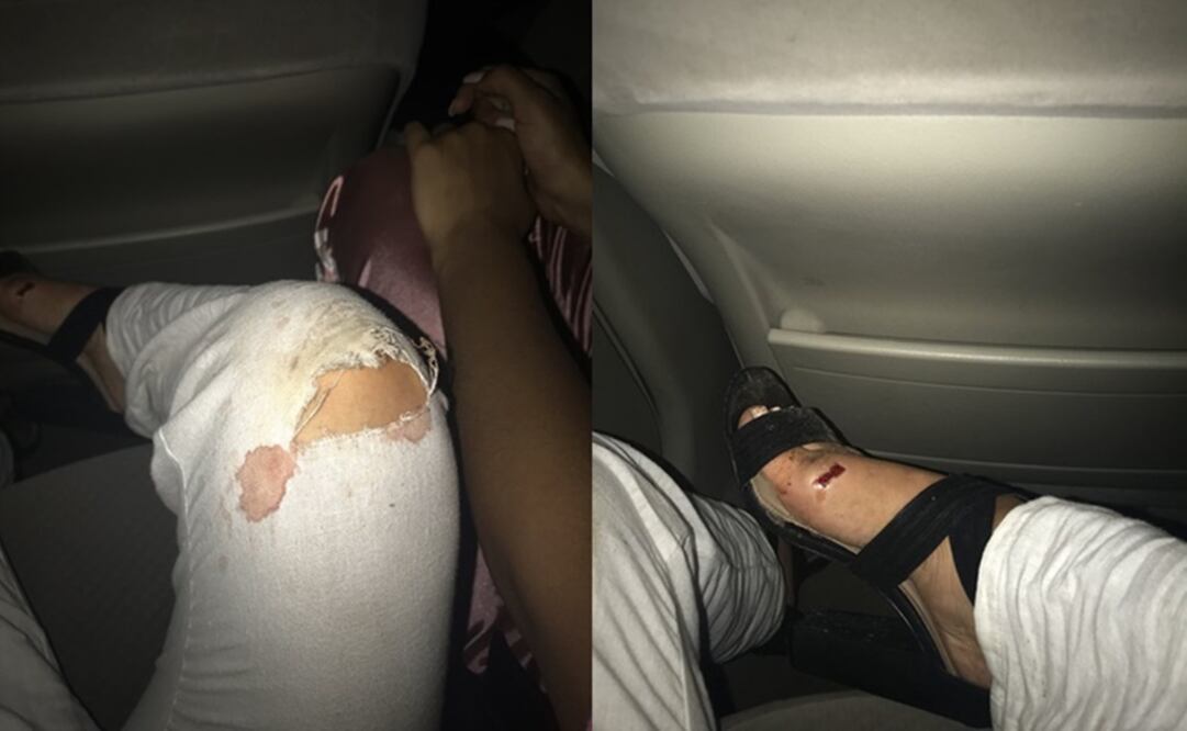 La joven sufrió heridas en manos, rodillas y pies luego de salir del auto en busca de ayuda. Foto: Twitter @BrookeAdkins