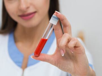 Conoce el nuevo análisis de sangre ideal para medir ácidos grasos omega-3
