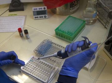 The IMSS to implement convalescent plasma therapy as COVID-19 treatment