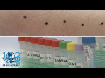 Método revolucionario para detectar alergias