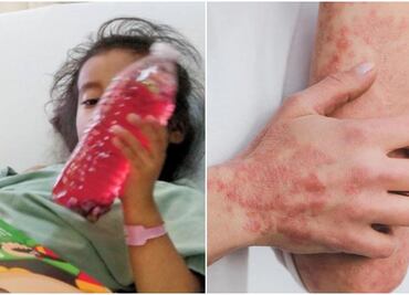 Por crisis sanitaria internacional, diputados alistan comparecencia de titulares de Cofepris e ISSSTE