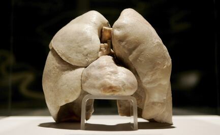 Estudio revela por qué los no fumadores padecen afecciones pulmonares graves