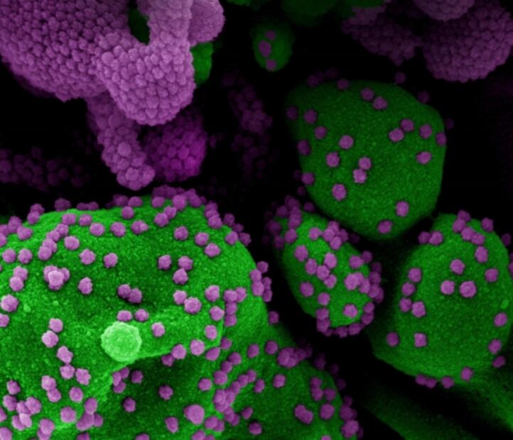 Descubren un nuevo tratamiento "eficaz" contra la inflamación por Covid-19