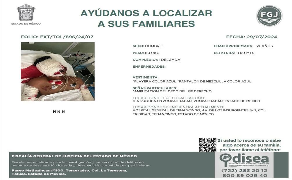 FGJ del Edomex pide ayuda para localizar familiares de un hombre gravemente herido en Tenancin. Foto: Especial