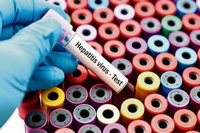 Día Mundial contra la Hepatitis: ¿qué es y por qué se conmemora cada 28 de julio?; conoce sus síntomas