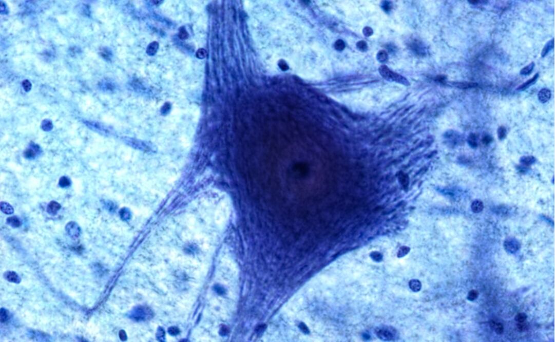 Una neurona vista bajo el microscopio. (FOTO: AMC)