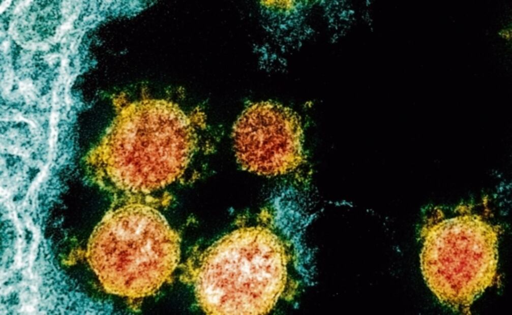 Inmunidad comprometida: Cuando el Covid-19 vive tras recuperarse