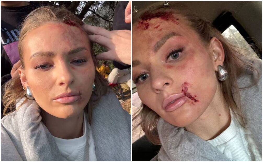 Irina Baeva, ensangrentada para su escena en la telenovela "La historia de Juana"