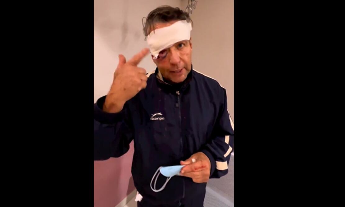 FOTO: del Instagram adamereacciona/EL UNIVERSAL/