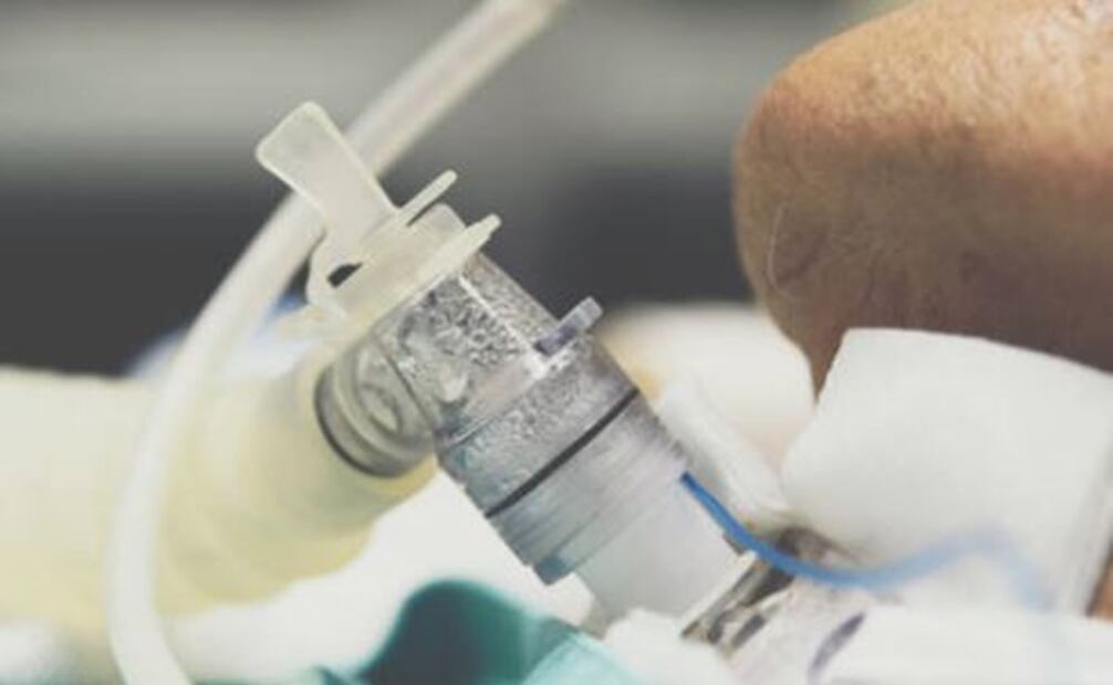 La traqueostomía es uno de los tratamientos para la insuficiencia respiratoria aguda.  Foto: Pixabay