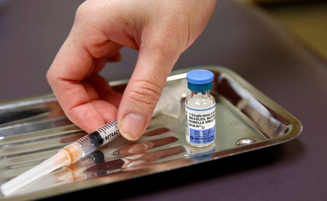 El sarampión es una enfermedad contagiosa, causada por un virus que infecta el tracto respiratorio y se extiende al resto del cuerpo (Foto: Reuters)